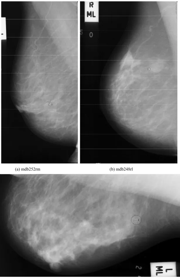 Figure 3.8 Results from the first implementation of the threshold technique
