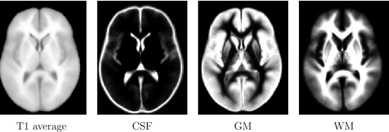 Figure 2.2: An example of probabilistic atlas: ICBM452 [34] probabilistic atlas showing the average topology of the brain and probabilistic map of CSF, GM, and WM.