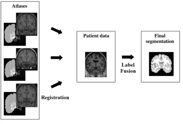 Figure 2.3: Multi-atlas-based segmentation procedure.
