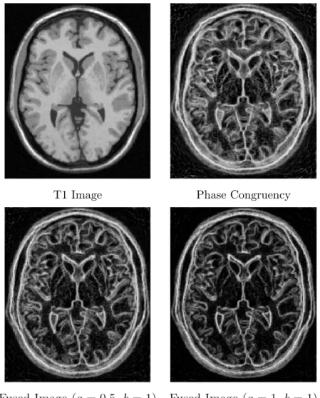 Figure 5.4: Effect of applying gradient magnitude on PC for a slice of T1 brain MR image.