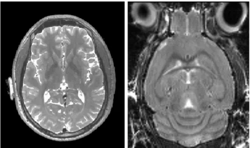 Figure 1.1: Comparison of an in vivo T2W of human brain from a 3T clinical scanner (Left) and an in vivo T2W mouse brain from a 7T preclinical scanner (Right)