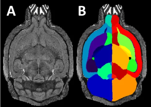 Figure 1.2: (A) An en vivo T2 mouse brain MRI, and (B) It’s corresponding automatic struc- struc-tural parcellation result.