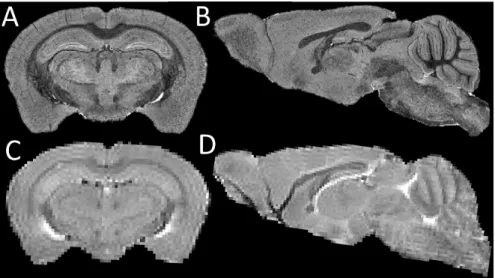 Figure 1.3: Top row: (A) coronal view and (B) sagittal view of an ex vivo T2 mouse brain MRI; Bottom row: (C) coronal view and (D) sagittal view of an in vivo T2 mouse brain MRI acquired from the same sample