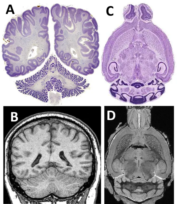 Figure 1.5: Comparison between human and mouse cortex, both in cerebrum and cerebellum.