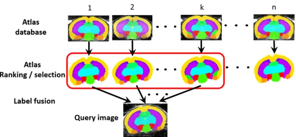 Figure 2.3: Schematic diagram of multi-atlas structural parcellation. The labels of each atlas in the database are propagated to the enquiry image through image registration and ranked