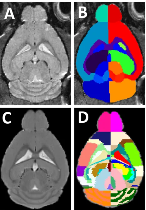 Figure 3.2: Sample images of current multi-atlas database. Images on the top show (A) a tem- tem-plate image of the MRM NeAt atlas database, with (B) its corresponding manual delineated structural labels
