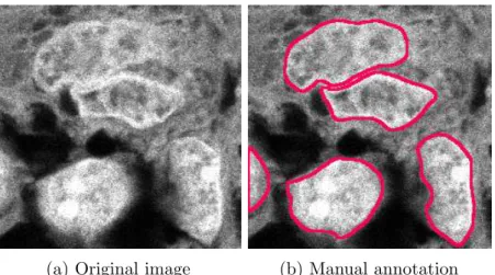 Figure 4.1: DAPI channel of original tissue image of glioblastoma cells and ground truth annotation.