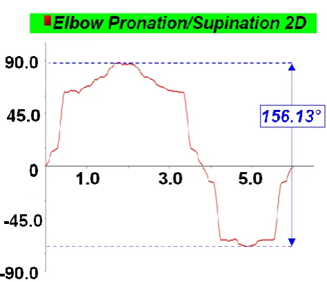 Fig. 14.  Exoskeleton prototype elbow pronation/supination angular  variation [degrees] vs