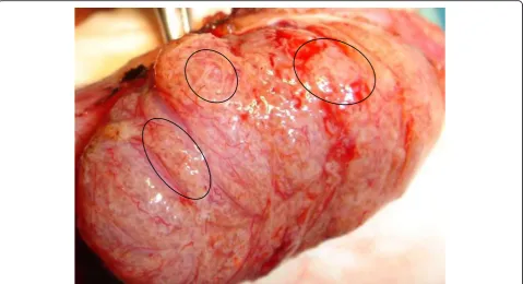 Fig. 4 Multiple histological patterns within the testis. Legend: From left to right: 1- Maturation arrest; 2- Sertoli Cell Only pattern; 3- Dilated tubules