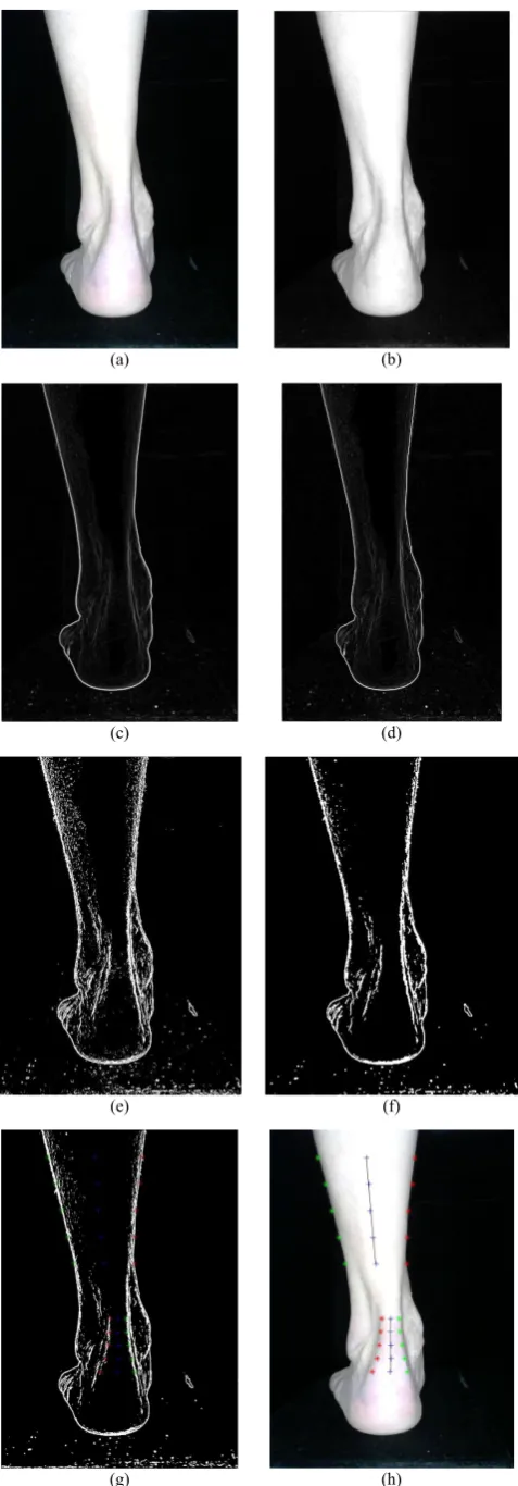 Fig. 9, respectively. The midlines of the tibia and calcaneus 