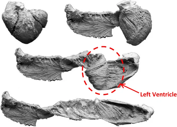 Figure 12: Detailed HVMB dissection steps [14] 