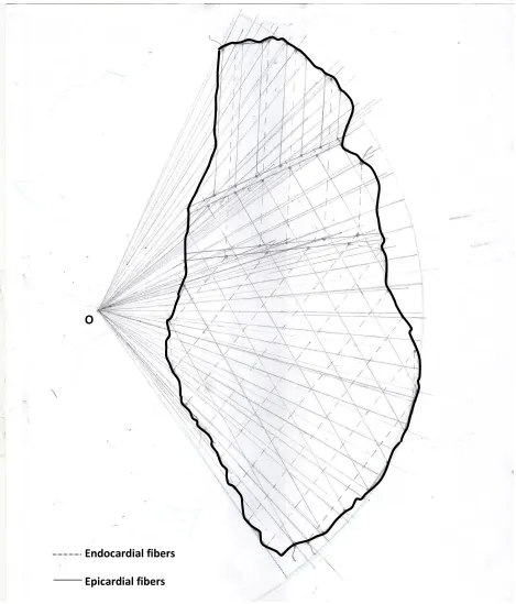 Figure 41: Idealized LV band trace with epicardial (hard lines) and endocardial (dashed lines) 