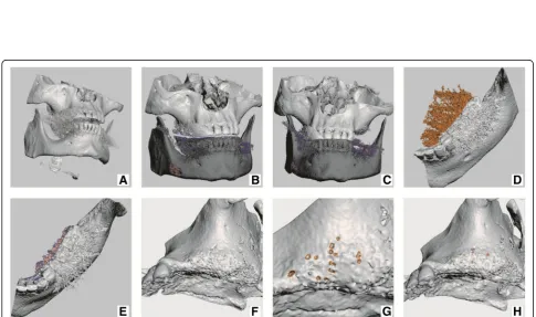 Fig. 3 3D Slicer user interface, thresholding tool: thresholding level selected using slider or entering numerical value (depicted by red rectangle).Bone label (standard from Slicer3D) is visualized by ivory colour in slice image (depicted by red arrows)