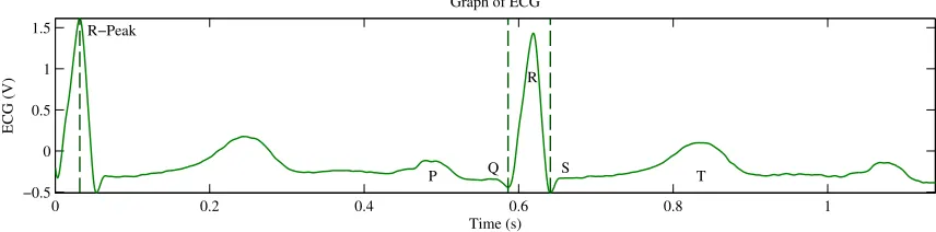 Figure 1.3: Graph of ECG Signal