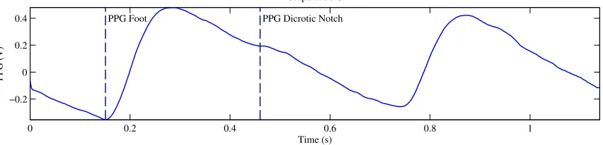 Figure 1.4: Graph of PPG Signal