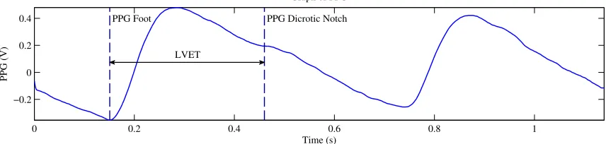 Figure 1.6: Graph Depicting the LVET