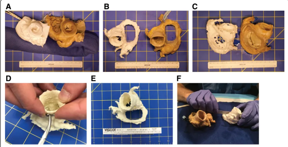 Fig. 1 Physical measurements of 3D printed cardiac models and cadaveric hearts. a-c Three examples of cadaveric hearts and theircorresponding 3D printed models, used for measuring features of the aortic valve (a, b) and the mitral valve (b, c)