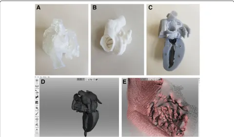 Fig. 4 Surface scanning success was dependent on model surface characteristics. Models printed in clear (used for surface scan testing