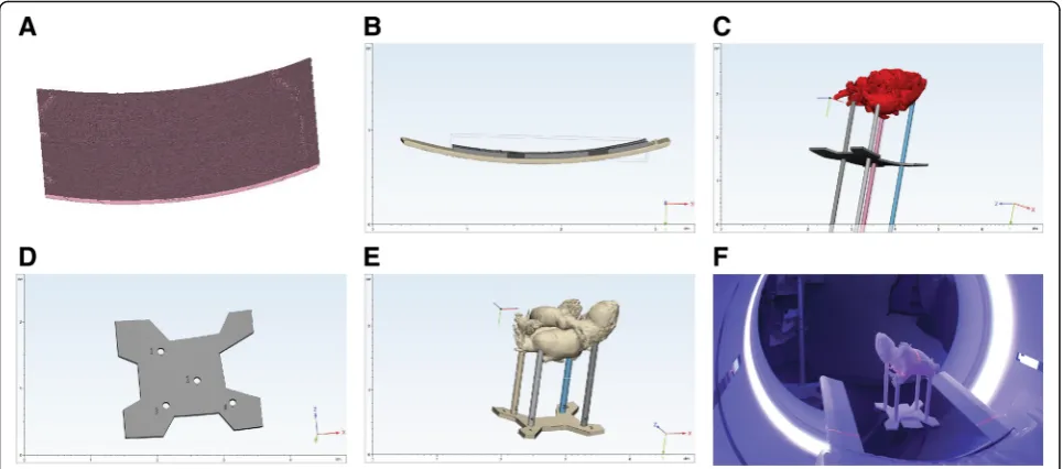 Fig. 5 3D model-specific heart holder for optimal positioning during CT scanning.the time of model segmentation and creation.Table.the model and the table adaptor piece