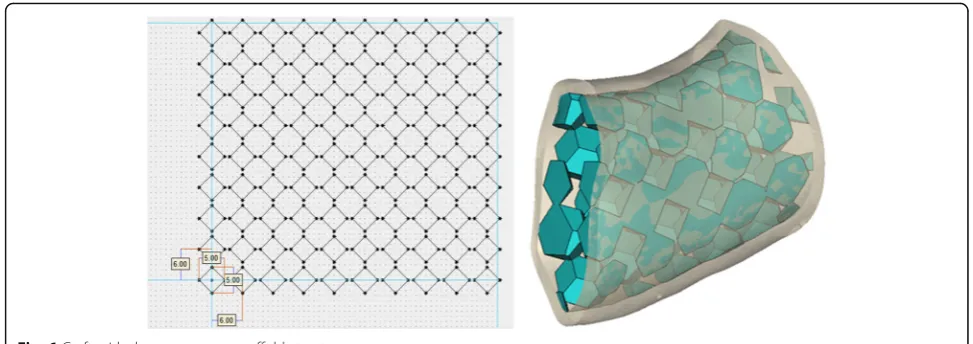 Fig. 7 Schematic of mandibular grafts with printing angle 0° (left) and 90° (right)
