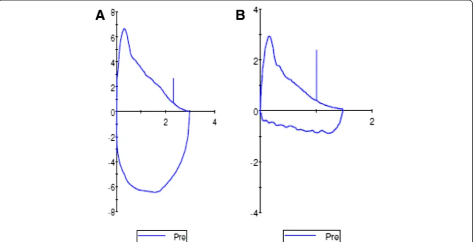 Fig. 2 a Normal flow volume loop in asymptomatic patient. b Example of flattening, early truncation and saw-tooth pattern of inspiratory limb offlow volume loop in a patient with vocal cord dysfunction