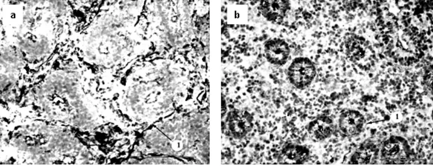Figure 2. Tissue sections of kidney (cortex)(a) rabbit; (b) cattle; 