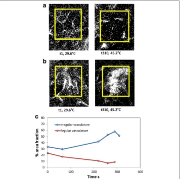 Fig. 10 Percentage area fraction analysis of QD perfusion during RF exposure in irregular tumor versus regular vessel