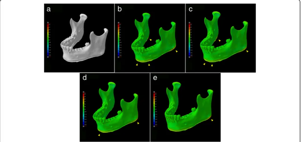 Fig. 3 Visualization of shape error (signed differences) for each 3D CAD model. Warm color shows expansion rather than reference 3D CAD data,cold color shows shrinkage