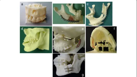 Fig. 5 Structures fabricated as support materials (support was installed.arrowheads). a To increase the contact area with the heating table of 3D printer, a plate-like b To prevent deformation due to its own weight, a columnar support was installed