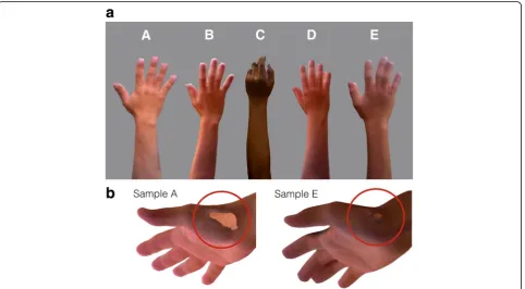 Fig. 1 Limb samples from five volunteers (a) Limb samples; (b) Sample A and E and associated flaws