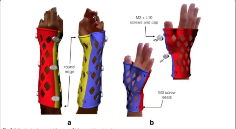 Fig. 2 Defined splint features (a) 3-part set, (b) 2-part set for wrist splint