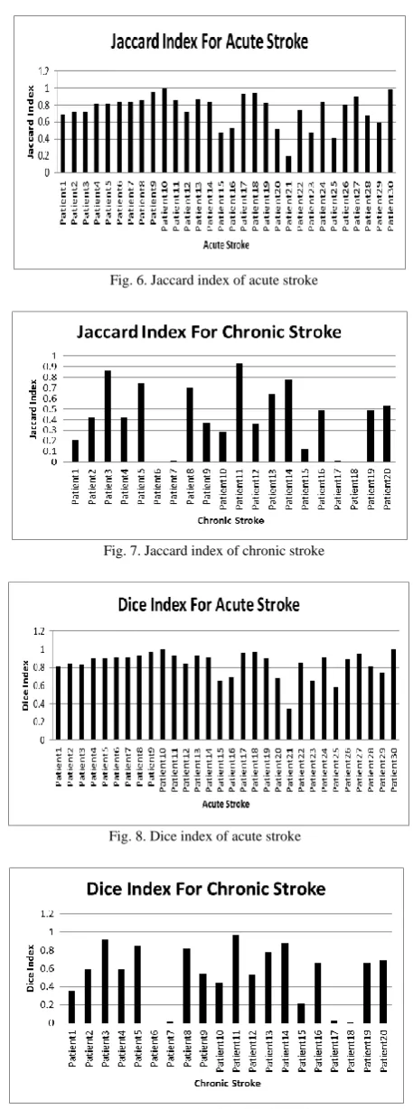 Fig. 9. Dice index for chronic stroke 