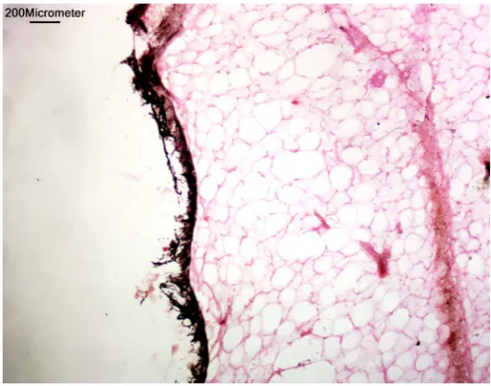 Figure 3. Negative surgical margin in intraoperative frozen section, black line indicate inked margin (Hematoxylin & eosin staining, 100x)