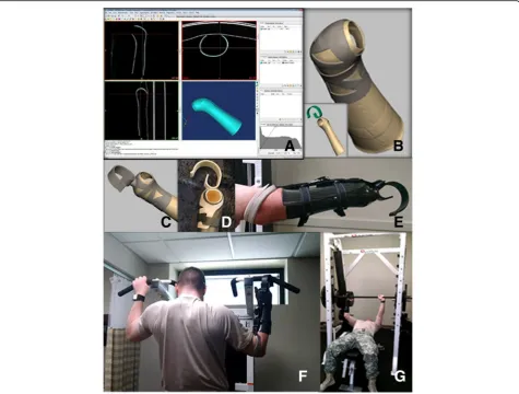 Fig. 2 Weight Lifting Adapter.overlay and laminated into the socket. Prosthetist added a ratchet system with strap extending around the elbow for pulling exercises