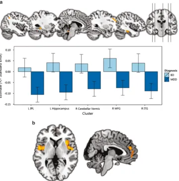 Figure 2. (a) Regions showing differences between major depression disorder (MDD) and bipolar disorder (BD)