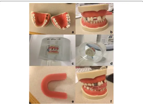 Fig. 1 Artificial denture (a and b) placed in a 20 cm water phantom and (c and d) used for the phantom study with display of a jaw spacer (e and f)