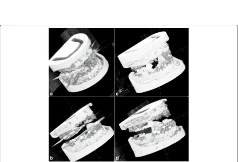Fig. 3 Slice series of the phantom acquisition with and without gantry tilt. In addition, all series were reconstructed with dedicated metal artifactreduction (MAR)