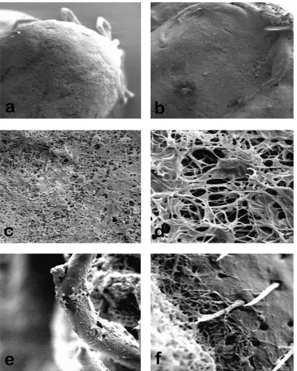Fig. 2.  fungal mycelia on the cuticle of killed ticks which shows signs of fungal grow in dorsal and ventral surface of respectively (magnification ×25); c–d