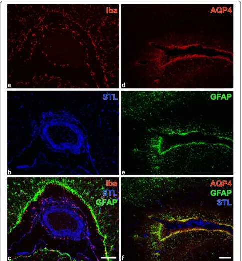 Fig. 2 Focal brain lesion in an alpaca (Vicugna pacos): Fluorescence labeling to characterize intralesional microglia/macrophages and astroglia
