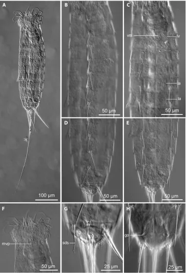 Fig. 2 Light microscope photos ments 7–11dorsal view1–8 segments 7–11 f1–2segments 10–11 of Tubulideres seminoli gen