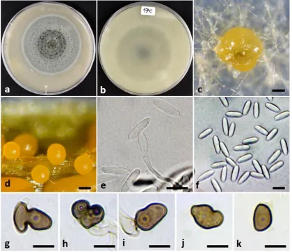 Fig. 5.  (c–db);  = 50 μm; Colletotrichum godetiae (UTFC 258), (IRAN 2447 C). a–b. Cultures on OA, 10 days growth, upper (a) and reverse c