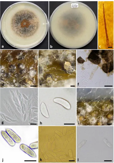 Fig. 6.  and reverse (stem. Colletotrichum karstii (UTFC 242), (IRAN 2448 C). a–b. Cultures on OA, 10 days growth, upper (a) b)
