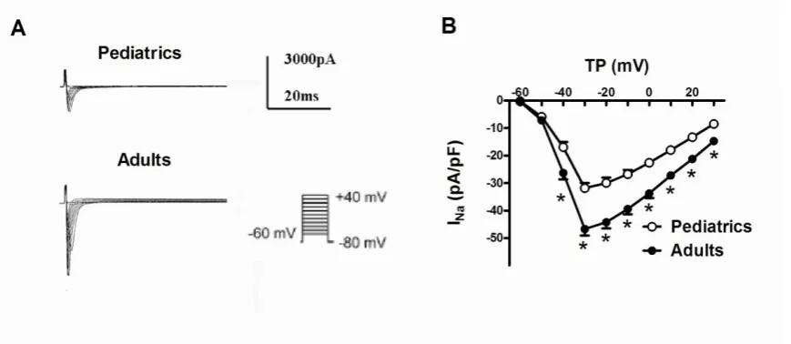 Fig. 1. Representative traces of sodium currents recorded in adult and pediatric atrial cells