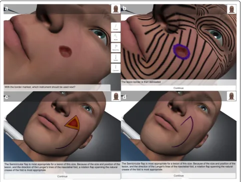 Fig. 4 User progression example. a Basal cell carcinoma image presented in the nasolabial fold of the patient model for the semi-circular rotationflap module