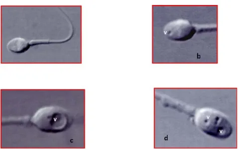 Fig. 1 Spermatozoïdes humains observés au microscope inverséen contraste de Nomarski, 3300 ×