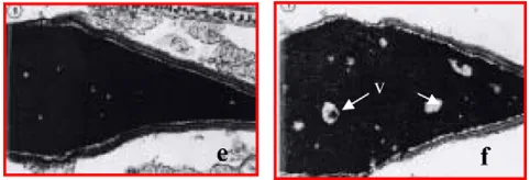 Fig. 2 Coupes de spermatozoïdes humains observées en micro-scopie électronique à transmission d’après Bedford et al