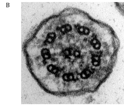 Figure 1a: Electron micrograph showing transverse section of a cilium lacking outer 