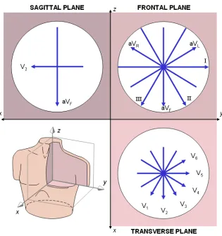 Figure 1-2. Graphical representation of the lead vectors captured with a 12-lead ECG. This model assumes a spherical conductor (white circle) and a centrally located single dipole source for the cardiac signals.5 
