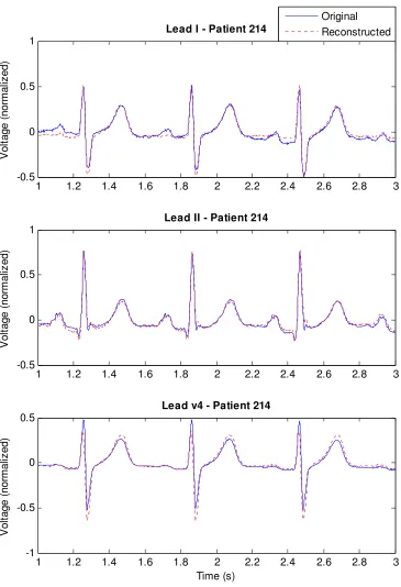 Figure 2-1. Plot of original and reconstructed leads for a male, age 35, of the healthy control group