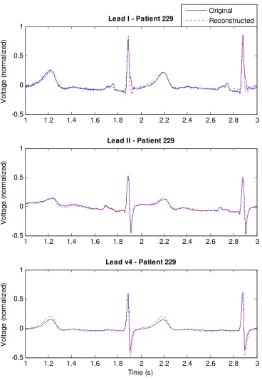 Figure 2-2. Plot of original and reconstructed leads for a male, age 55, of the healthy control group